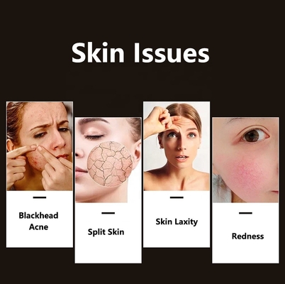 Compacta Skin Led Facial Light Therapy para Melhoria da Acne de grau profissional