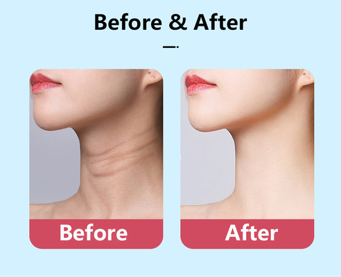 Potência nominal 2.5W LED Terapia Neck Rejuvenation V-Face Lifting Massager para anti-envelhecimento