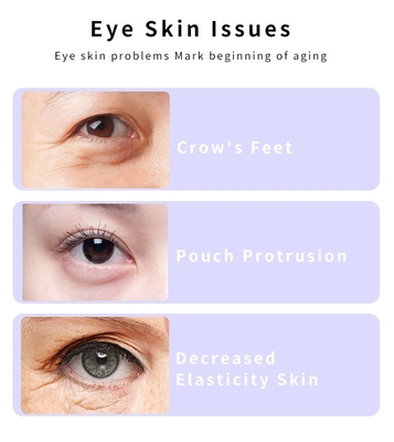 Cuidados de Saúde Pessoal 155*18,3*23,4 mm Rotação Microcorrente Ems Massagista Ocular Pulseira